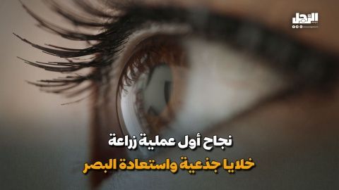 نجاح أول عملية زراعة خلايا جذعية واستعادة البصر (فيديوجراف)